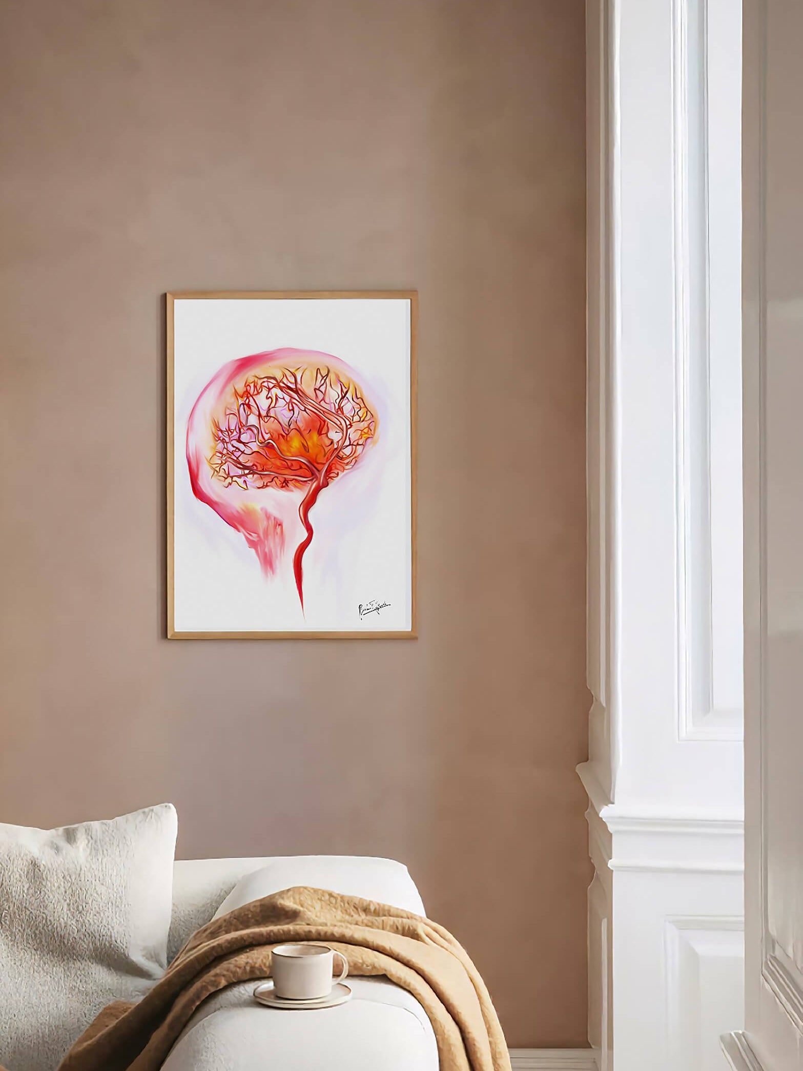 Abstract cerebral angiography art print-Brain Art-Neurology cardiovascular art-wall art-vascular surgeon neurosurgeon neurologist gift