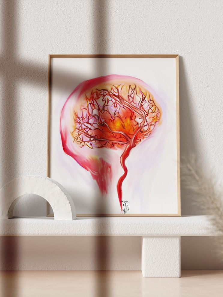 Abstract cerebral angiography art print-Brain Art-Neurology cardiovascular art-wall art-vascular surgeon neurosurgeon neurologist gift