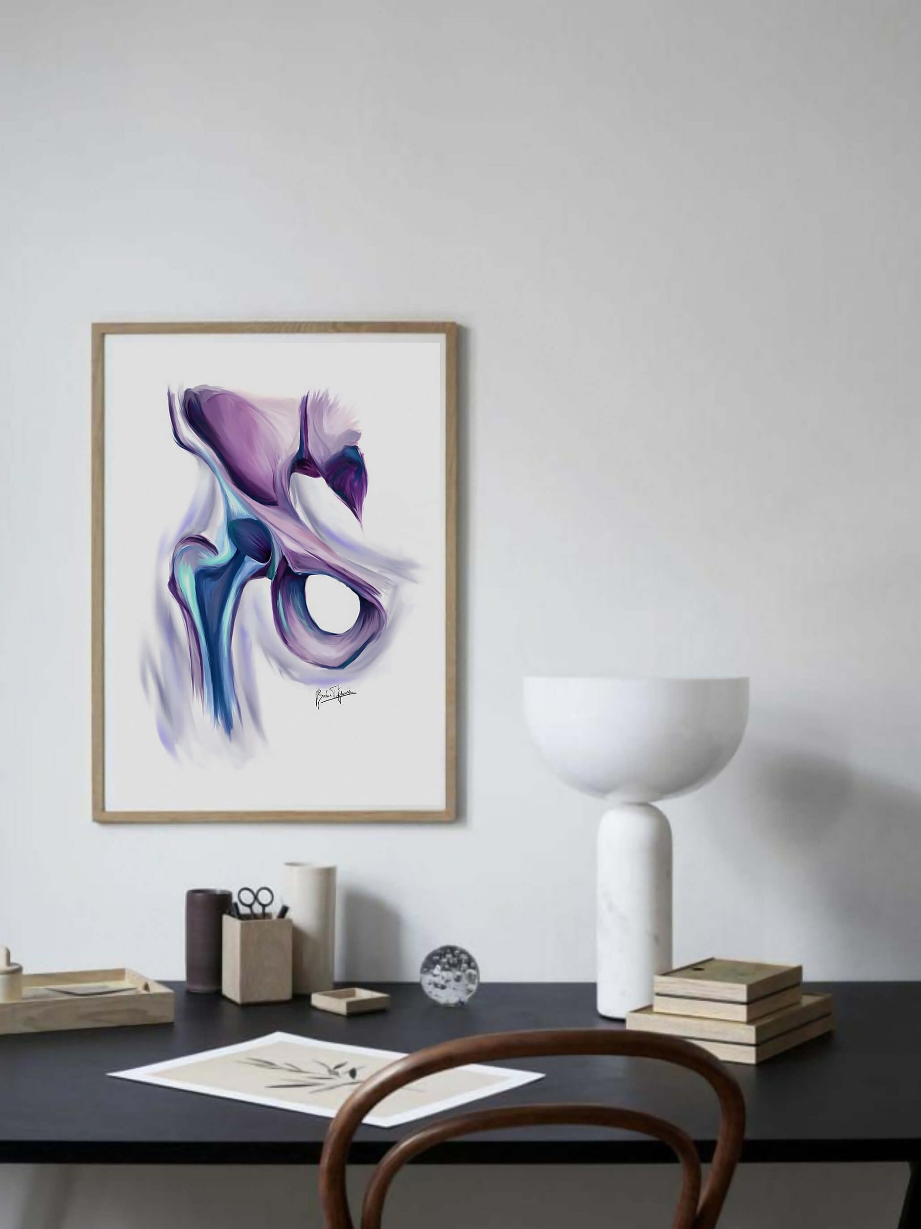 hip-replacement-art-print-orthopedic-surgery-artwork-hip-anatomical-art-musculoskeletal-anatomy-orthopedic-surgeon-gift