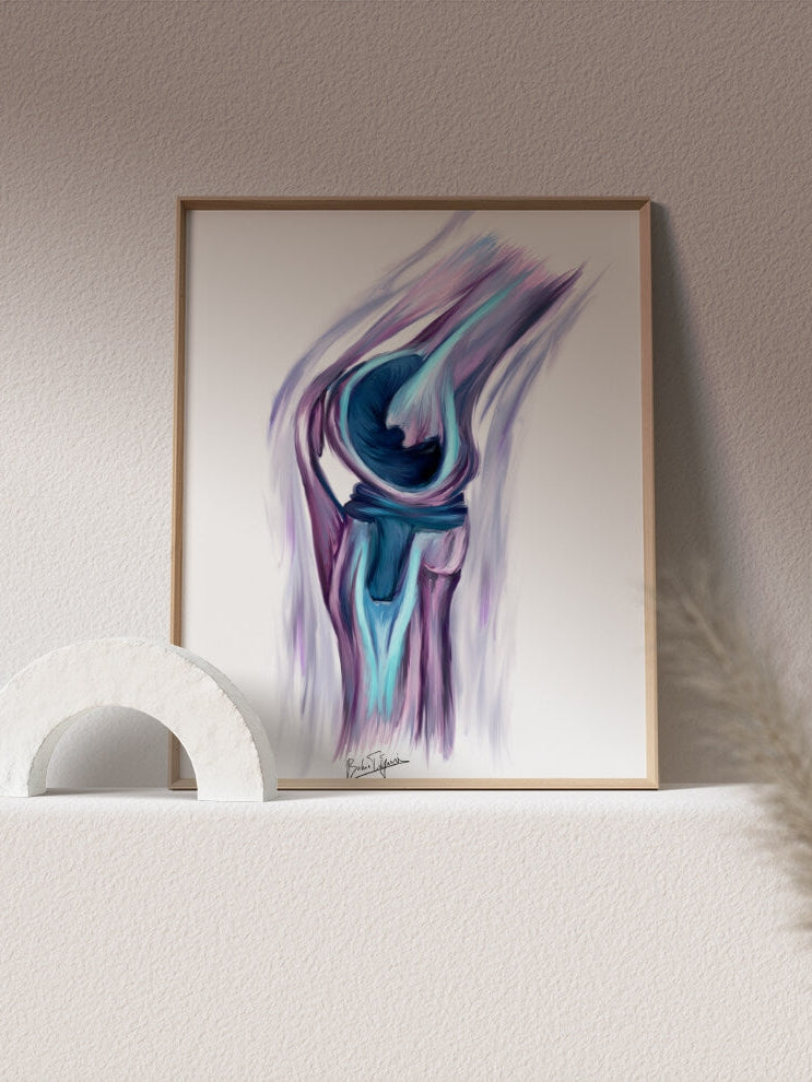 knee replacement art print-orthopedic surgery print-join replacement art - musculoskeletal anatomy-Orthopedic surgeon gift