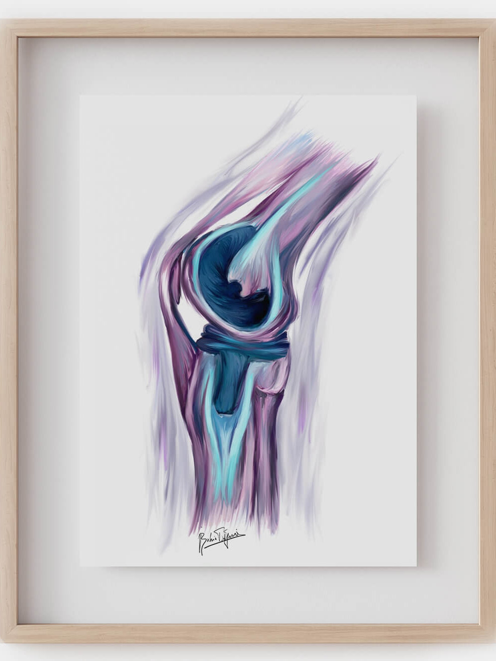 knee replacement art print-orthopedic surgery print-join replacement art - musculoskeletal anatomy-Orthopedic surgeon gift