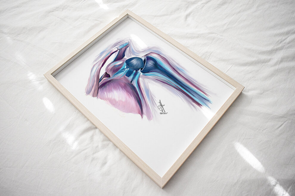 Shoulder replacement art print-Orthopedic surgery art-anatomical art - musculoskeletal anatomy-joint replacement-Orthopedic surgeon gift