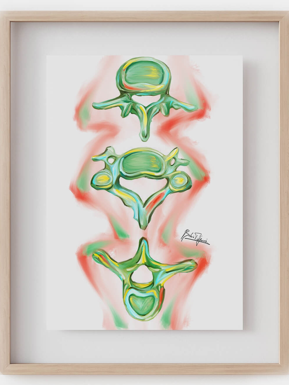 Abstract three cervical, thoracic and lumbar vertebrae art print-Orthopedic surgeon Chiropractor gift-Anatomical spine- Bone artwork