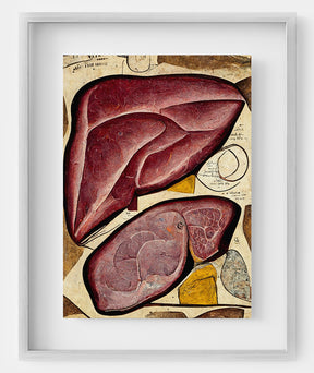 Liver Anatomy Art Print – Gastroenterologist Clinic Decor