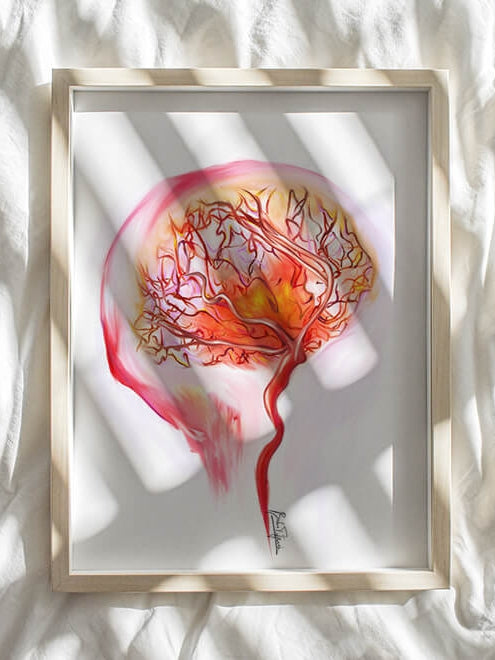 Cerebral angiography art print