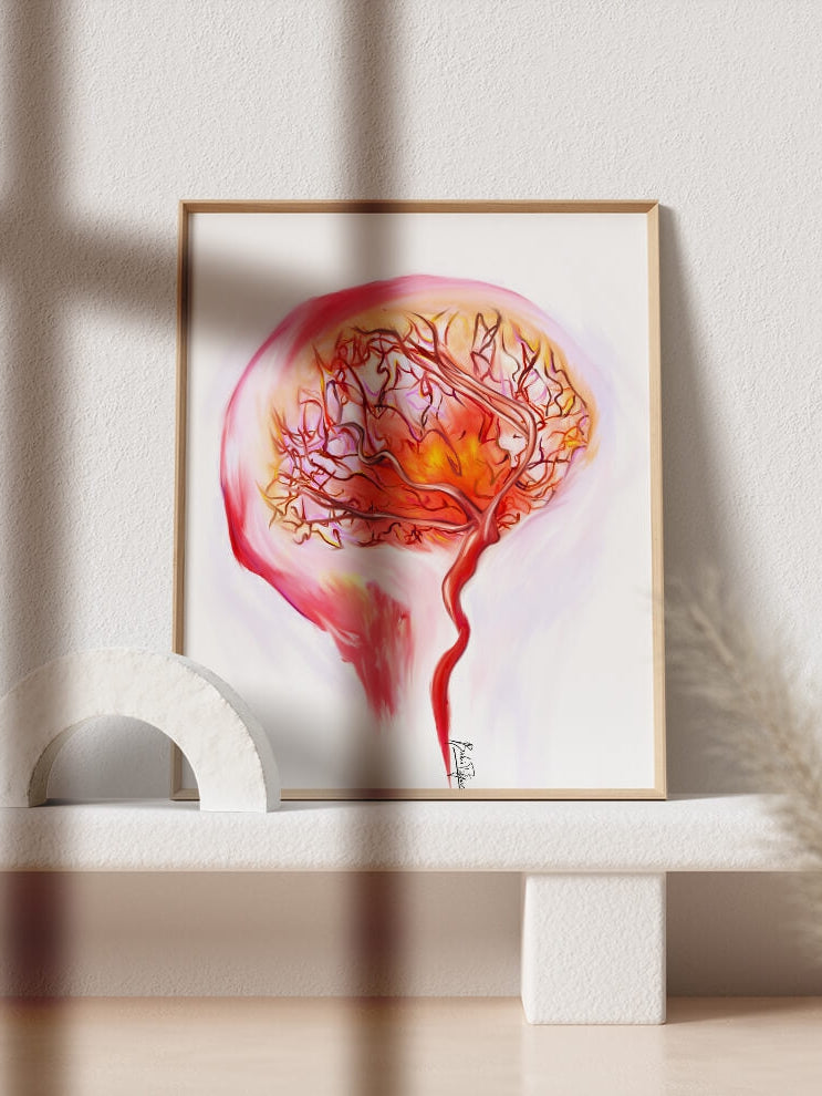Abstract cerebral angiography art print-Brain Art-Neurology cardiovascular art-wall art-vascular surgeon neurosurgeon neurologist gift