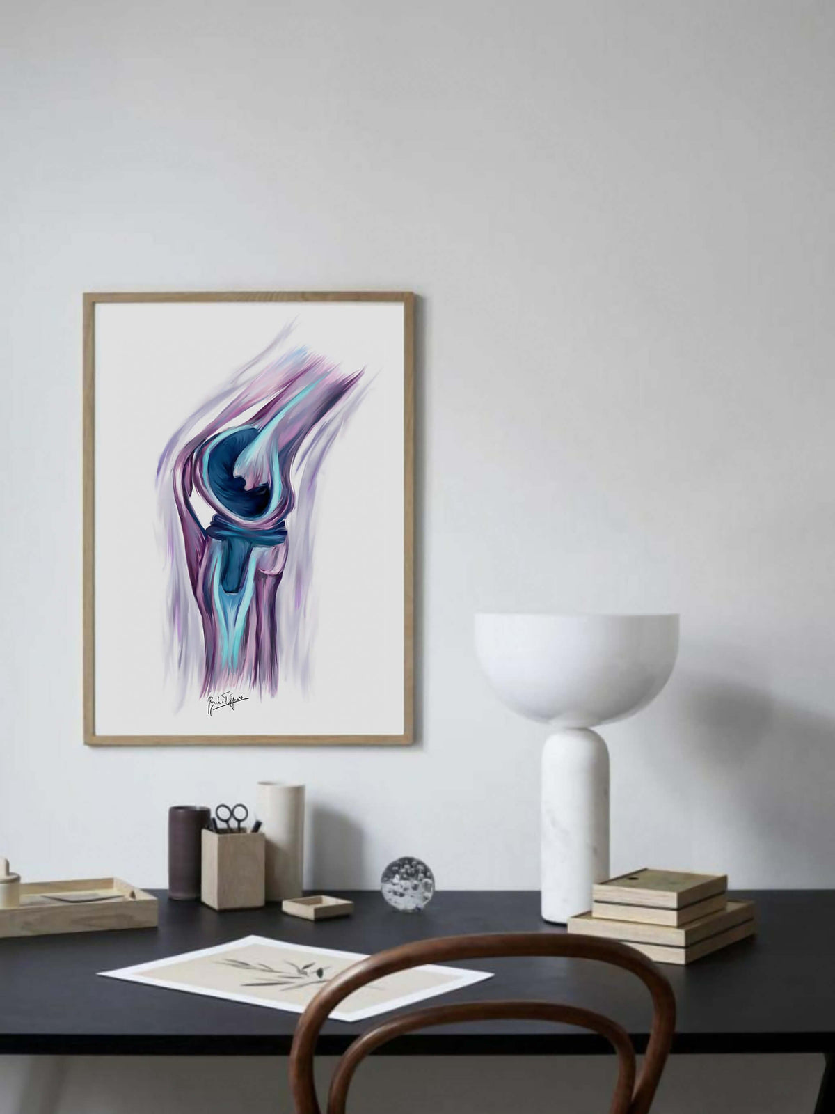knee replacement art print-orthopedic surgery print-join replacement art - musculoskeletal anatomy-Orthopedic surgeon gift