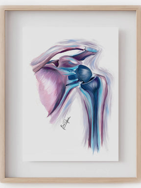 Shoulder replacement art print-Orthopedic surgery art-anatomical art - musculoskeletal anatomy-joint replacement-Orthopedic surgeon gift