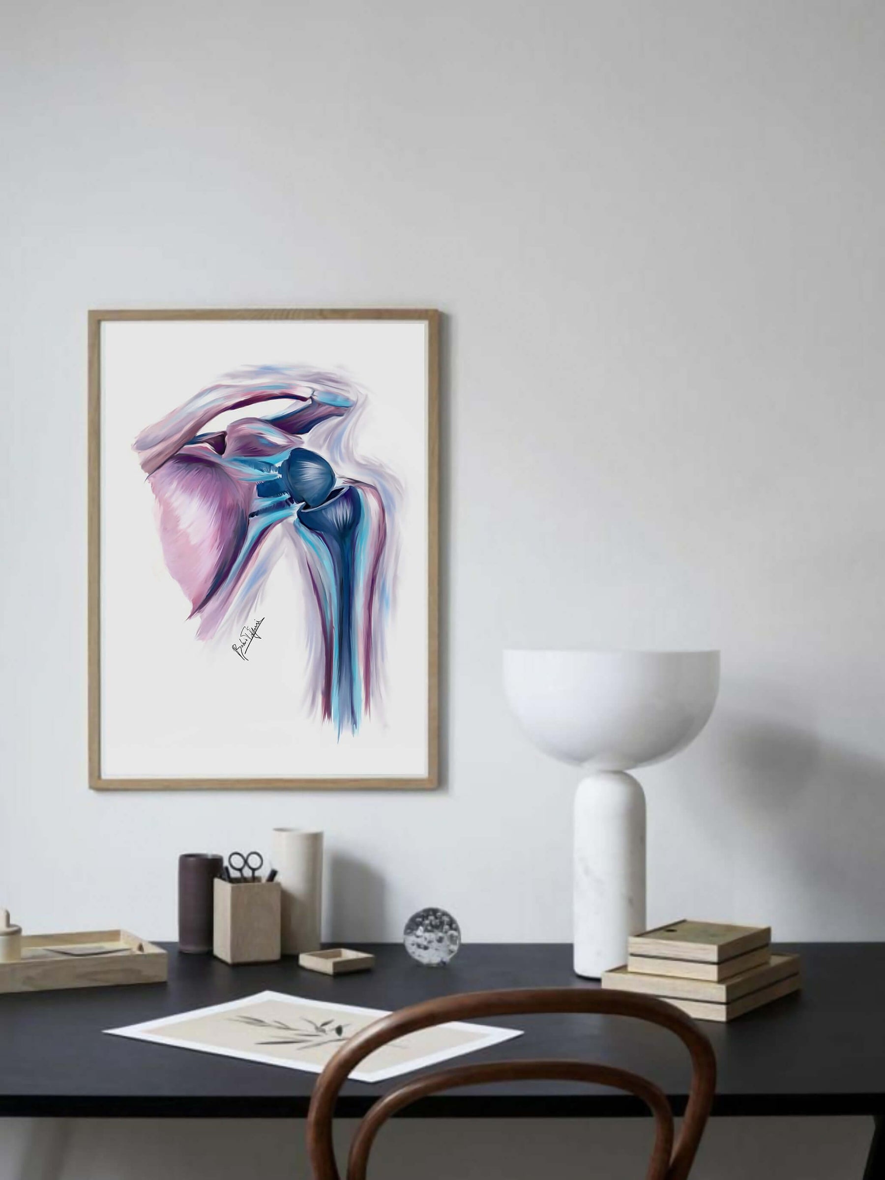 Shoulder replacement art print-Orthopedic surgery art-anatomical art - musculoskeletal anatomy-joint replacement-Orthopedic surgeon gift